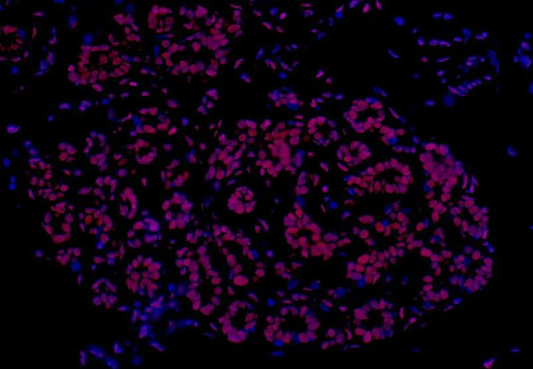 Immunohistochemistry (Formalin/PFA-fixed paraffin-embedded sections) - Anti-TLS/FUS antibody [BLR023E] - BSA free (AB272077)