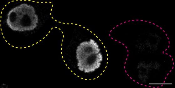 Immunocytochemistry/ Immunofluorescence - Anti-TLS/FUS antibody [CL0190] (AB154141)