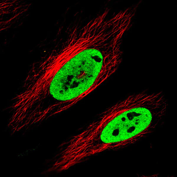 Immunocytochemistry/ Immunofluorescence - Anti-TLS/FUS antibody [CL0190] (AB154141)