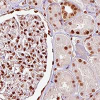 Immunohistochemistry (Formalin/PFA-fixed paraffin-embedded sections) - Anti-TLS/FUS antibody [CL0190] (AB154141)