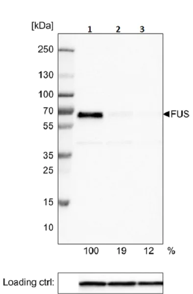 Western blot - Anti-TLS/FUS antibody [CL0190] (AB154141)