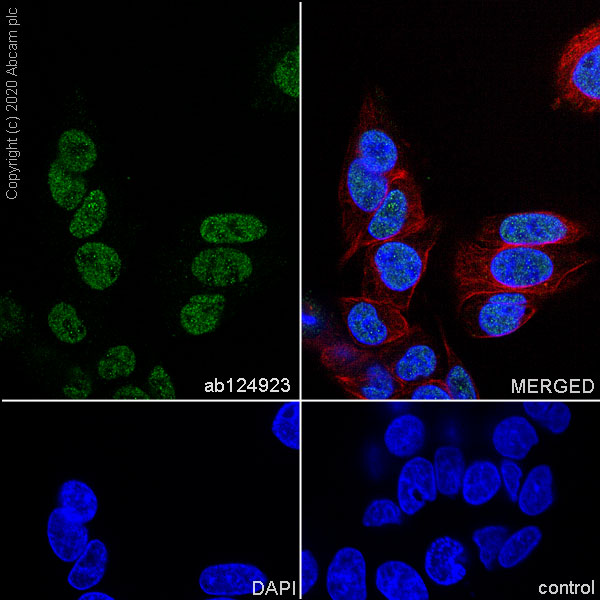 Immunocytochemistry/ Immunofluorescence - Anti-TLS/FUS antibody [EPR5812] (AB124923), expandable thumbnail
