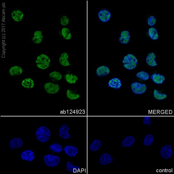 Immunocytochemistry/ Immunofluorescence - Anti-TLS/FUS antibody [EPR5812] (ab124923), expandable thumbnail