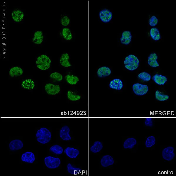 Immunocytochemistry/ Immunofluorescence - Anti-TLS/FUS antibody [EPR5812] (AB124923)
