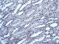 Immunohistochemistry (Formalin/PFA-fixed paraffin-embedded sections) - Anti-TLS/FUS antibody [EPR5812] (ab124923), expandable thumbnail