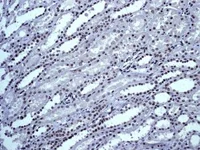 Immunohistochemistry (Formalin/PFA-fixed paraffin-embedded sections) - Anti-TLS/FUS antibody [EPR5812] (AB124923)