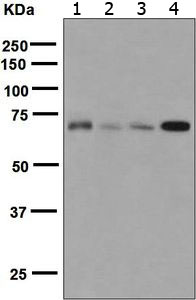 Western blot - Anti-TLS/FUS antibody [EPR5812] (ab124923), expandable thumbnail