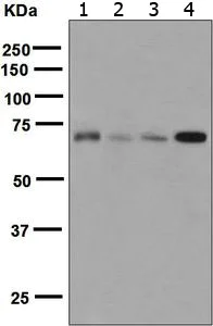 Western blot - Anti-TLS/FUS antibody [EPR5812] (AB124923)