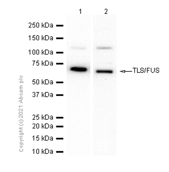 Western blot - Anti-TLS/FUS antibody [EPR5812] (AB124923), expandable thumbnail