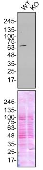Western blot - Anti-TLS/FUS antibody [EPR5812] (AB124923), expandable thumbnail