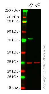 Western blot - Anti-TLS/FUS antibody [EPR5812] (ab124923), expandable thumbnail