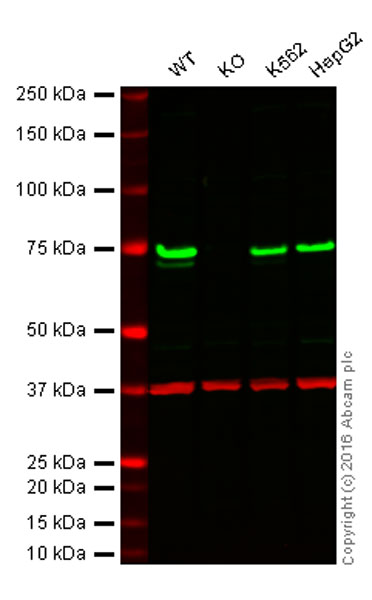 Western blot - Anti-TLS/FUS antibody [EPR5812] (ab124923), expandable thumbnail