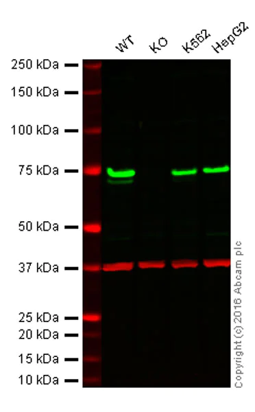 Western blot - Anti-TLS/FUS antibody [EPR5812] (AB124923)