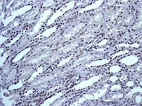 Immunohistochemistry (Formalin/PFA-fixed paraffin-embedded sections) - Anti-TLS/FUS antibody [EPR5812] - BSA and Azide free (AB232065)