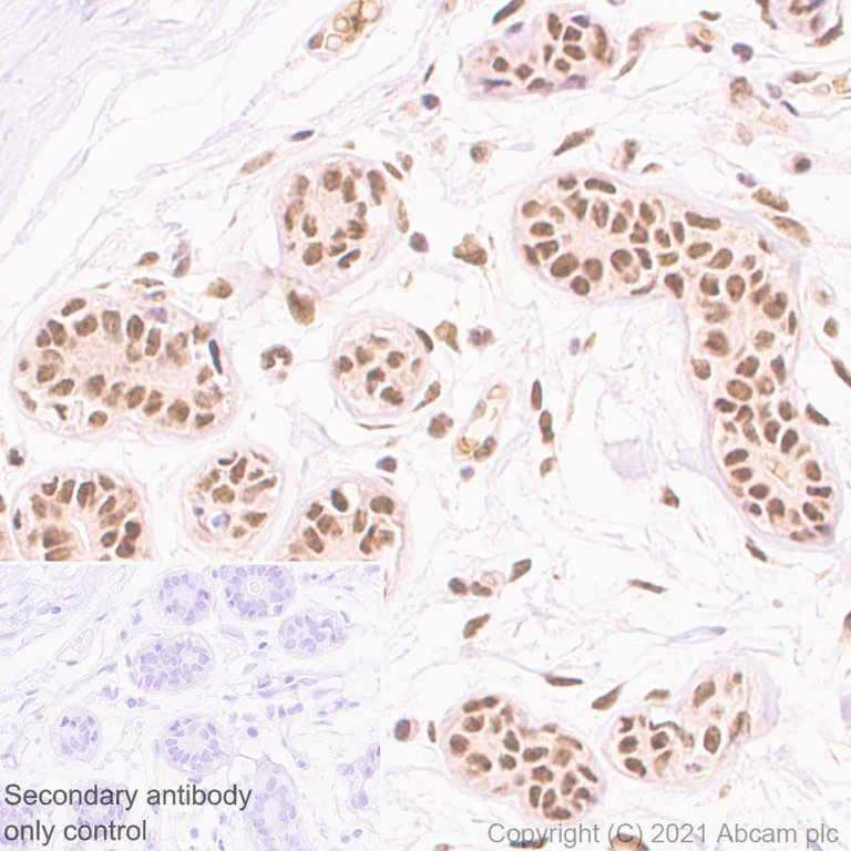 Immunohistochemistry (Formalin/PFA-fixed paraffin-embedded sections) - Anti-TLS/FUS antibody [EPR5812] - BSA and Azide free (AB232065)