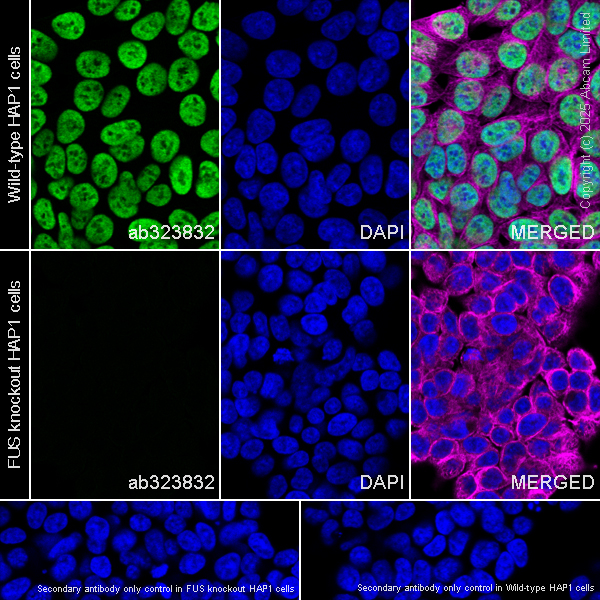 Immunocytochemistry/ Immunofluorescence - Anti-TLS/FUS antibody [P3-A6C4] (AB323832), expandable thumbnail