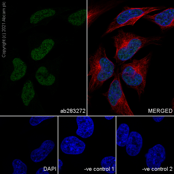 Immunocytochemistry/ Immunofluorescence - Anti-TLS/FUS antibody [Z-FUS-5] - Mouse IgG2a (Chimeric) - BSA and Azide free (ab283297), expandable thumbnail