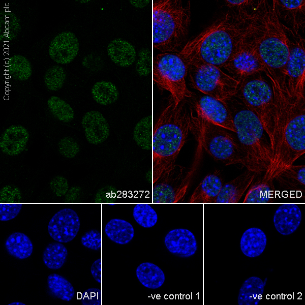 Immunocytochemistry/ Immunofluorescence - Anti-TLS/FUS antibody [Z-FUS-5] - Mouse IgG2a (Chimeric) - BSA and Azide free (AB283297), expandable thumbnail