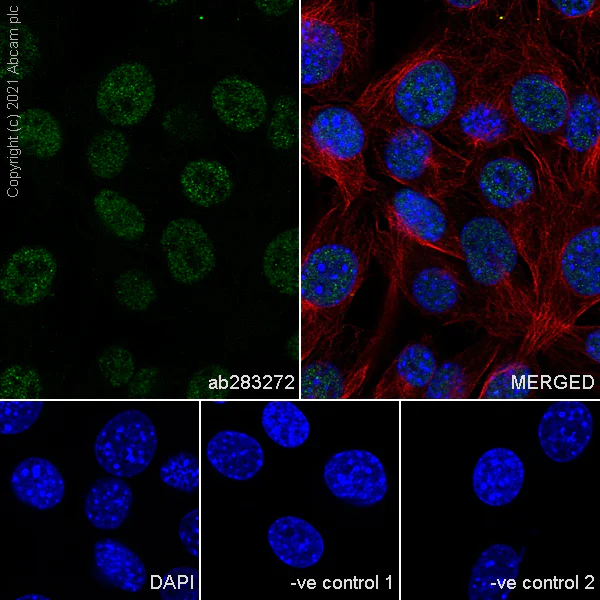 Immunocytochemistry/ Immunofluorescence - Anti-TLS/FUS antibody [Z-FUS-5] - Mouse IgG2a (Chimeric) - BSA and Azide free (AB283297)