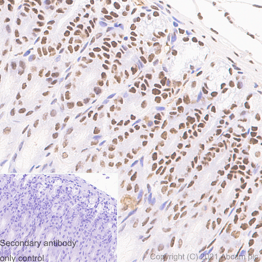 Immunohistochemistry (Formalin/PFA-fixed paraffin-embedded sections) - Anti-TLS/FUS antibody [Z-FUS-5] - Mouse IgG2a (Chimeric) - BSA and Azide free (AB283297), expandable thumbnail