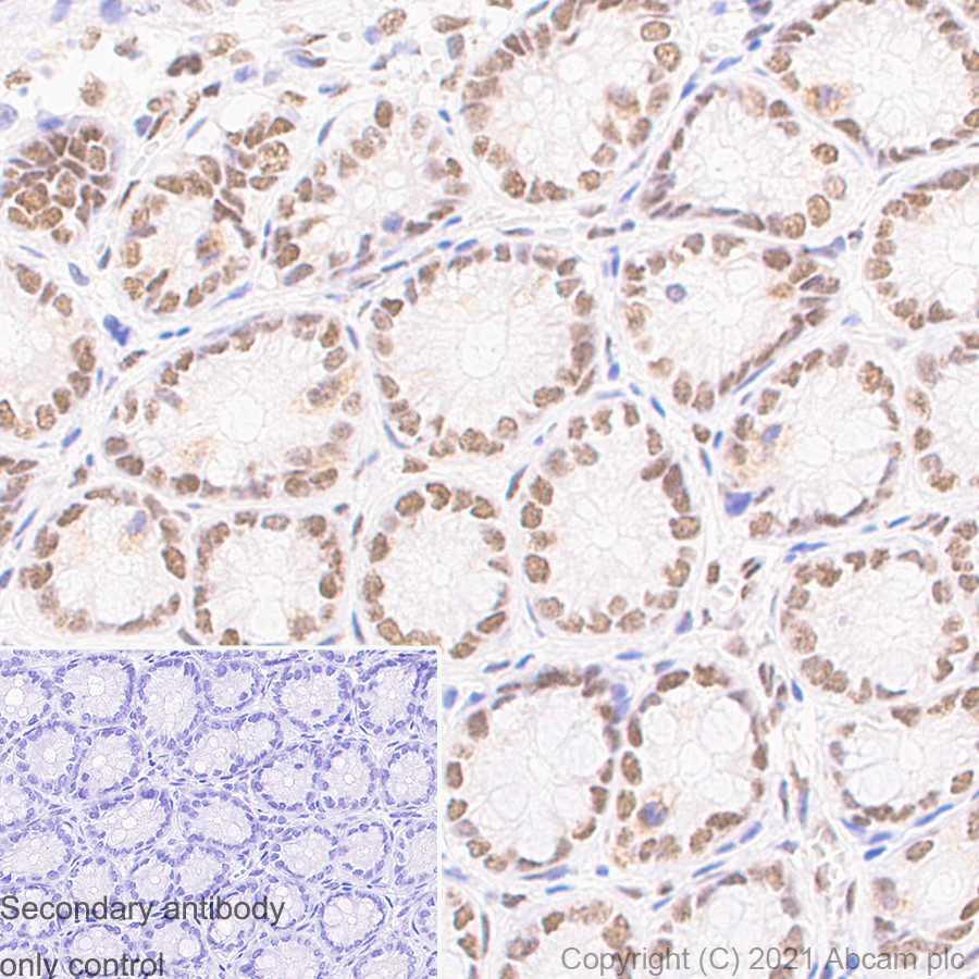 Immunohistochemistry (Formalin/PFA-fixed paraffin-embedded sections) - Anti-TLS/FUS antibody [Z-FUS-5] - Mouse IgG2a (Chimeric) - BSA and Azide free (AB283297), expandable thumbnail