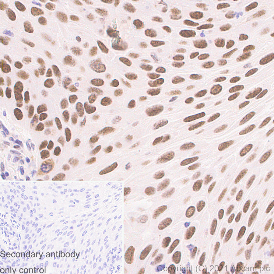 Immunohistochemistry (Formalin/PFA-fixed paraffin-embedded sections) - Anti-TLS/FUS antibody [Z-FUS-5] - Mouse IgG2a (Chimeric) - BSA and Azide free (ab283297), expandable thumbnail