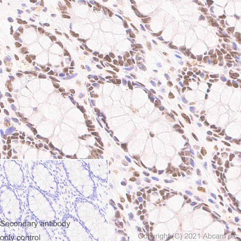 Immunohistochemistry (Formalin/PFA-fixed paraffin-embedded sections) - Anti-TLS/FUS antibody [Z-FUS-5] - Mouse IgG2a (Chimeric) - BSA and Azide free (AB283297)