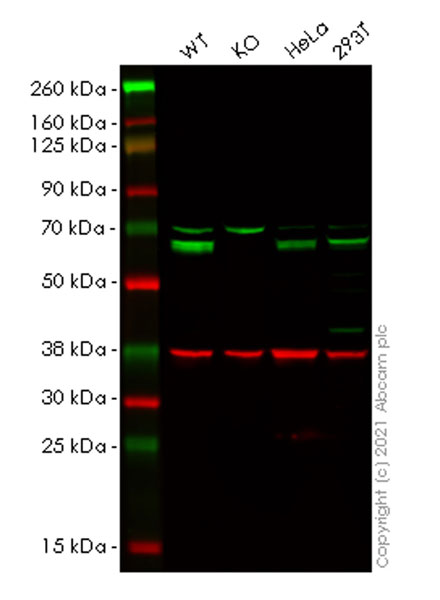 Western blot - Anti-TLS/FUS antibody [Z-FUS-5] - Mouse IgG2a (Chimeric) - BSA and Azide free (AB283297), expandable thumbnail
