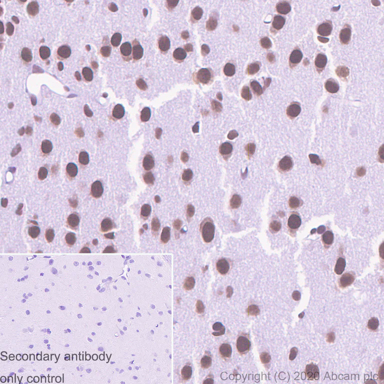 Immunohistochemistry (Formalin/PFA-fixed paraffin-embedded sections) - Anti-TLS/FUS (methyl ) antibody [9G6] (AB252830)