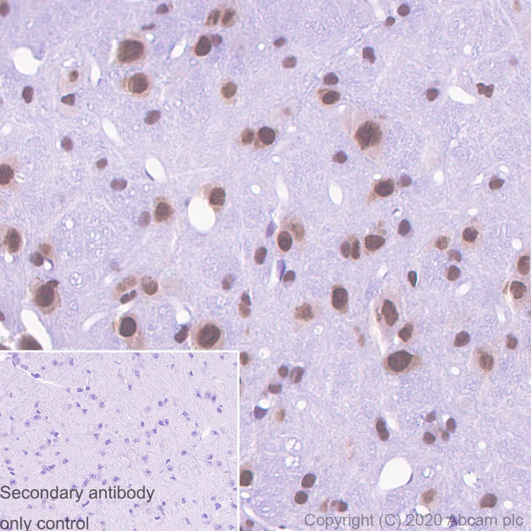 Immunohistochemistry (Formalin/PFA-fixed paraffin-embedded sections) - Anti-TLS/FUS (methyl ) antibody [9G6] (AB252830)