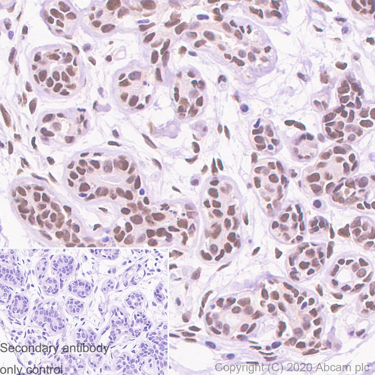 Immunohistochemistry (Formalin/PFA-fixed paraffin-embedded sections) - Anti-TLS/FUS (methyl ) antibody [9G6] - BSA and Azide free (AB255786)