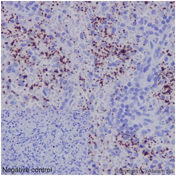 Immunohistochemistry (Formalin/PFA-fixed paraffin-embedded sections) - Anti-TLT-1 antibody [EP15294] (AB192619)
