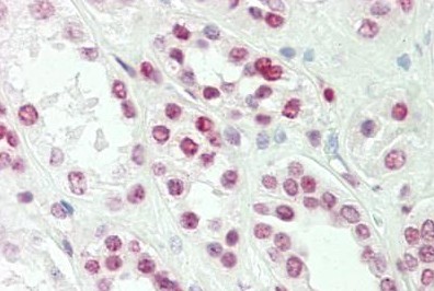 Immunohistochemistry (Formalin/PFA-fixed paraffin-embedded sections) - Anti-TLX1 antibody (AB191270)