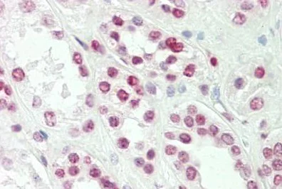 Immunohistochemistry (Formalin/PFA-fixed paraffin-embedded sections) - Anti-TLX1 antibody (AB191270)