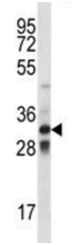 Western blot - Anti-TLX1 antibody (AB191270)