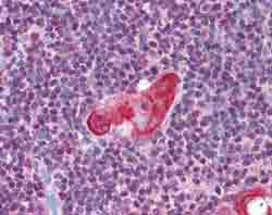 Immunohistochemistry (Formalin/PFA-fixed paraffin-embedded sections) - Anti-TLX1 antibody (AB78498), expandable thumbnail