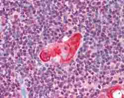 Immunohistochemistry (Formalin/PFA-fixed paraffin-embedded sections) - Anti-TLX1 antibody (AB78498)