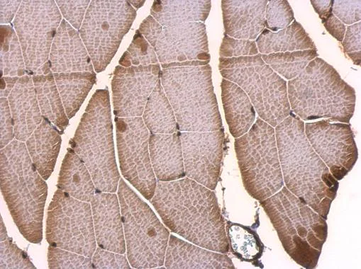 Immunohistochemistry (Formalin/PFA-fixed paraffin-embedded sections) - Anti-TLX3 antibody (AB184011)