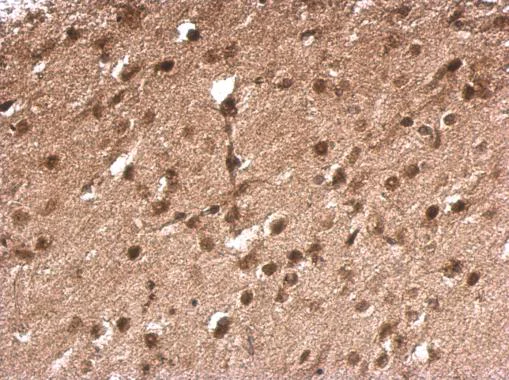Immunohistochemistry (Formalin/PFA-fixed paraffin-embedded sections) - Anti-TLX3 antibody (AB184011)