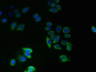 Immunocytochemistry/ Immunofluorescence - Anti-TM14A antibody (AB236904)