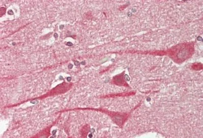 Immunohistochemistry (Formalin/PFA-fixed paraffin-embedded sections) - Anti-TM2D1/BBP antibody (AB230876)