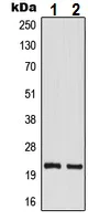 Western blot - Anti-TM2D1/BBP antibody (AB230876)