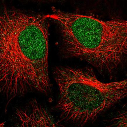 Immunocytochemistry/ Immunofluorescence - Anti-TM2D3 antibody (AB246013), expandable thumbnail