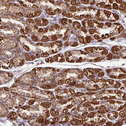 Immunohistochemistry (Formalin/PFA-fixed paraffin-embedded sections) - Anti-TM2D3 antibody (AB246013)