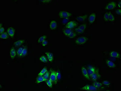 Immunocytochemistry/ Immunofluorescence - Anti-TM41A antibody (AB236850)