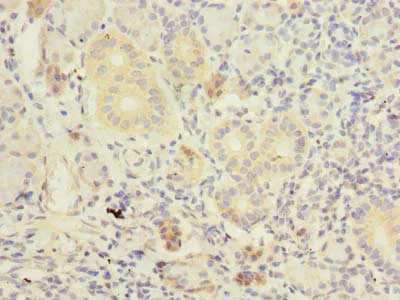 Immunohistochemistry (Formalin/PFA-fixed paraffin-embedded sections) - Anti-TM41A antibody (AB236850)