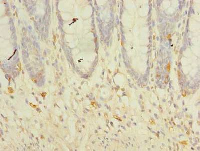 Immunohistochemistry (Formalin/PFA-fixed paraffin-embedded sections) - Anti-TM41A antibody (AB236850)