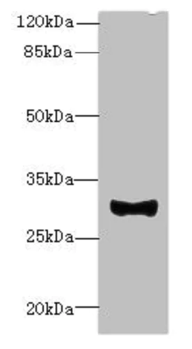 Western blot - Anti-TM41A antibody (AB236850)