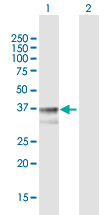 Western blot - Anti-TM6SF2 antibody (AB169629)