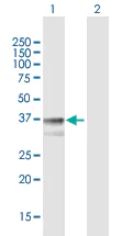 Western blot - Anti-TM6SF2 antibody (AB169629)